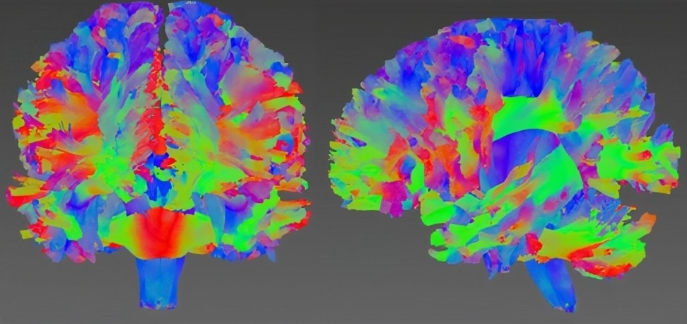 3D Fiber Reconstruction